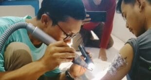 Aksi Hapus Tato Gratis PAC Grib Jaya Tarogong Kidul Disambut Meriah Warga Garut