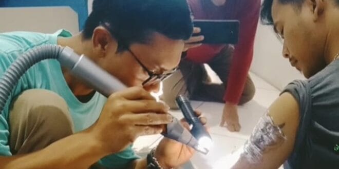 Aksi Hapus Tato Gratis PAC Grib Jaya Tarogong Kidul Disambut Meriah Warga Garut